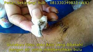 Sebab, pada dasarnya pisau cukur yang digunakan berfungsi sebagai pencukur rambut. Cara Menghilangkan Bulu Kemaluan Dengan Putih Telur Menghilangkan Masalah