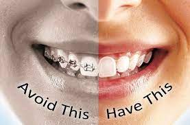 Razdolsky can help you better. Do Adult Braces Actually Work For Straightening Your Teeth