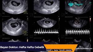 gebelik kesesi kac mm iken kalp atisi duyulur doktorlar kalp dis gebelik