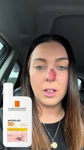 #skincancer #melanoma #larocheposay #dermatologist #oncodermatogist