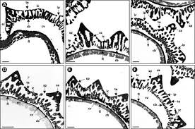 Image result for Anisopappus