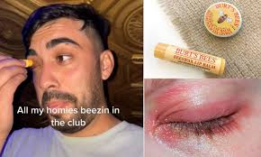 Dangerous' new TikTok trend sees people apply chapstick on their EYELIDS to  'get high' | Daily Mail Online