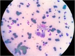 자신의 여자친구가 꼭 가졌으면 하는 희망사항들을 생각해보세요. Disseminated Histoplasmosis In A Cat Rescued In Fortaleza Brazil And Successfully Treated With Itraconazole First Case Report Identified Molecularly Sciencedirect
