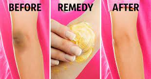 Walmart.com has been visited by 1m+ users in the past month 10 Natural Tricks To Remove Dark Knees And Elbows