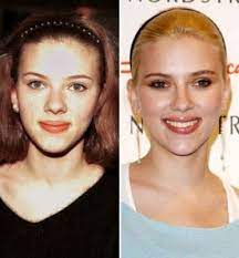 A post shared by scarlett johansson (@scarlett.johansson.fc) on aug 19, 2019 at 5:50am pdt. Scarlett Johansson Johansson Scarlett Plastische Chirurgie Hubsche Frau Frau