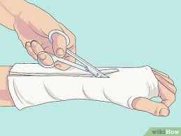 Shrinkins decorates walkers, wheelchairs, orthopedic casts and much more! How To Make A Plaster Cast Of An Arm 14 Steps With Pictures