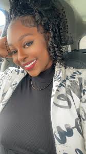 One-day composite veneers in Cali, Columbia