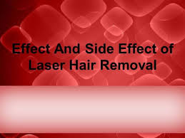 laser hair removal effects and side
