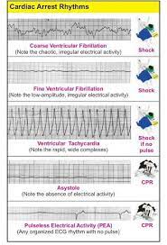 What are two rhythms that you cannot shock? Shockable And Non Shockable Rhythms Nursing School Tips Emergency Nursing Icu Nursing