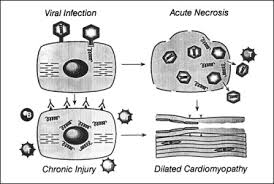 The possible pathophysiology and proposed guideline. Myocarditis And Pericarditis In Children Pediatric Clinics
