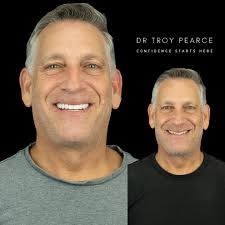 The next chapter just gets better🚀 20 porcelain veneers to revamp his  whole appearance. #smilemakeover #transformation #smile #newlife #health  #mood #youth #longevity #cincinnati #nky