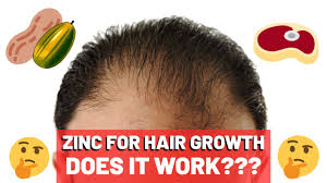 Today, hair loss is a common problem occurring all around the world. Zinc For Hair Growth Does It Work Youtube