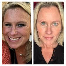 When Jessi from #MomTok starts raving about the LumiSpa in her stories… you  already KNOW it's about to blow up. 👀🤣💅 She's not wrong though — this is  the device I use