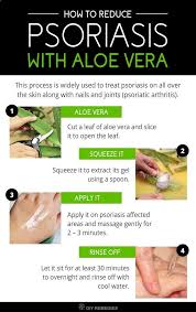 Psoriasis Diet How To Reduce Psoriasis With Aloe Vera It S Always Best To Use Aloe Vera In Fresh Gel Or Ju Psoriasis Cure Treat Psoriasis Psoriasis Remedies