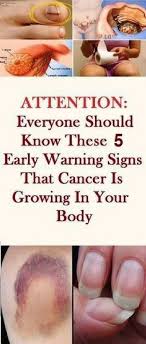 Six early signs of lung cancer include a new cough that persists for several weeks and goes on worsening, persistent shortness of breath, chest pain, and more. Pin On Health 1