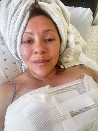 Breast Implant Removal and Recovery Experience