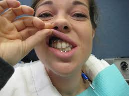 Runs for Cookies: 2011