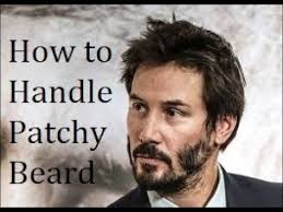 How to handle Patchy beard