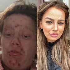 Erin Cataldo's Instagram, Twitter & Facebook