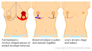 Pin On How Much Is Cosmetic Surgery