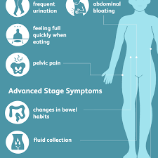 For years, the cancer risks involved with using hormone replacement therapy divided the medical community. Ovarian Cancer Signs Symptoms And Complications