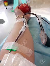 Blutspende wurde nils reudel von der feuerwehr jaderberg mit der blutspendenadel ausgezeichnet. Nadel In Das Blutspender Arm Wahrend Der Blutspende In Das Krankenhaus Lizenzfreie Fotos Bilder Und Stock Fotografie Image 39485359