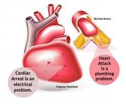 Epiphyseal arrest premature arrest of the longitudinal growth of bone due to fusion of the epiphysis and diaphysis. The Difference Between Heart Attack And Cardiac Arrest Luminis Health