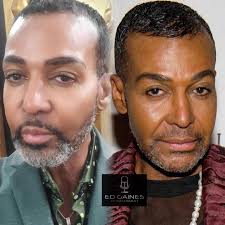 Our Prayers Are With You. Real Housewives of Atlanta” Star #DwightEubanks  Diagnosed with Prostate Cancer. •••••••••••••••••• “But I feel good,”  Eubanks stresses. “I'm 64, that's young to me…We're all going to go