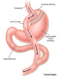 Don't waste your time with compliance. Gastriko Bypass Xeiroyrgos Sth 8essalonikh Dr Dhmhtrios Kanellos
