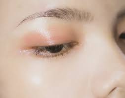 Asian brow lift before and after. Why The Asian Eyelid Lift Is No Longer Controversial Dr Malena Amato