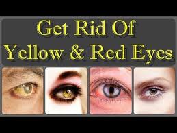 How To Get Rid From Yellow Eyes With Naturally Foods And Get White Eyes Youtube White Eyes Yellow Eyes Eyes