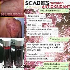 Ia gemar mengorek bahagian lipatan kulit dan bertelur di dalamnya. Ubat Makan Kudis Buta Perubatan E