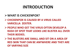 chickenpox ppt