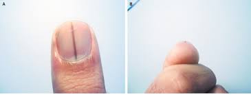 These dark or bluish spots don't just appear on nails: Helthbusiness If You Notice A Black Line In Your Nails That Means