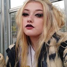 Does. Anyone notice antibiotics make their symptoms worse