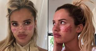 A bundle of energy and positivity, tilly entered the big brother house with the second lot of housemates aboard an. Hatdxax5a6hadm