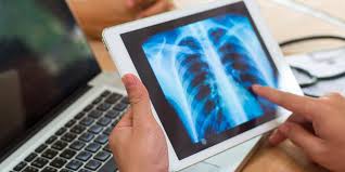 Lung Diseases