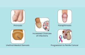 Image result for Phimosis