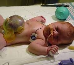 Exam 3 Prep Newborn Flashcards Quizlet