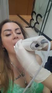 Hollywood Smile Transformation in Istanbul