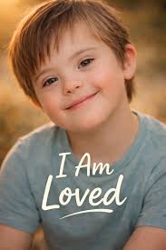 Small acts show true love and kindness