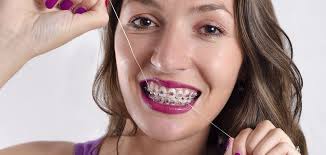 We did not find results for: How Do I Floss With Braces Best Way To Floss With Braces