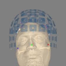 Using an automated approach to coregistration — MNE 1.1.1 documentation