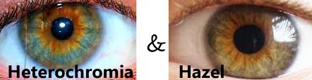 There is not a gradation in colors, but rather a distict transition from the inner color to the outer color of the iris. Heterochromia Iridum People With Two Different Colored Eyes Owlcation
