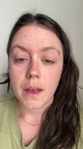 Eileen Bowen Therapist