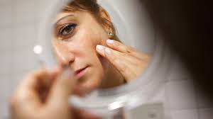 The most common type is atopic dermatitis. Seborrhoisches Ekzem Homoeopathie Sissach Liestal Basel Olten Bern Zurich Luzern