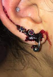 A New Earring Bleeding A Lot Piercing