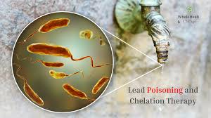 Image result for Lead Poisoning