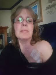 Individual bandage strips still