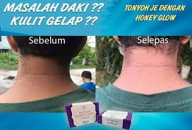 Maybe you would like to learn more about one of these? Sabun Pemutih Honey Glow Hilang Daki Istimewa Dan Terbaik Untuk Anda